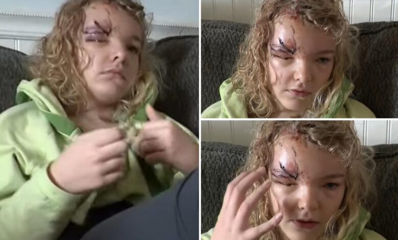 Long Island girl mauled by neighbor’s pitbull