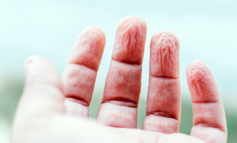 Why do our fingers wrinkle in water? It’s much deeper than skin. Why do our fingers wrinkle in water? It’s much deeper than skin.