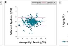 AI-powered app enables anemia screening using fingernail selfies