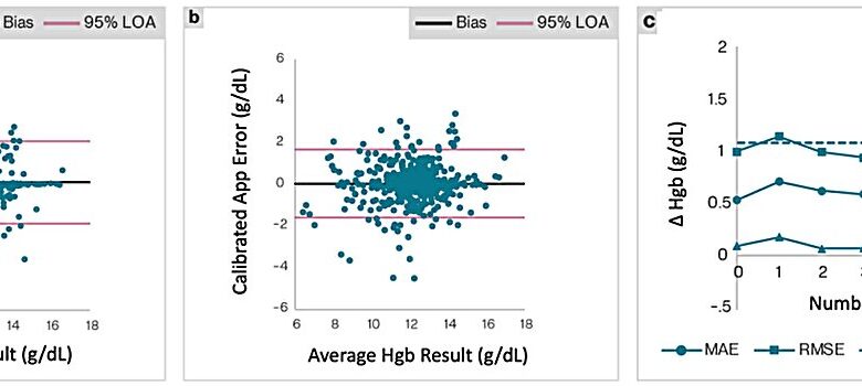 AI-powered app enables anemia screening using fingernail selfies AI-powered app enables anemia screening using fingernail selfies