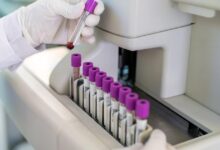 FDA greenlights marketing of first Alzheimer’s blood test for some patients