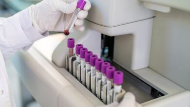 FDA greenlights marketing of first Alzheimer’s blood test for some patients
