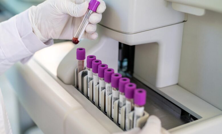 FDA greenlights marketing of first Alzheimer’s blood test for some patients FDA greenlights marketing of first Alzheimer’s blood test for some patients