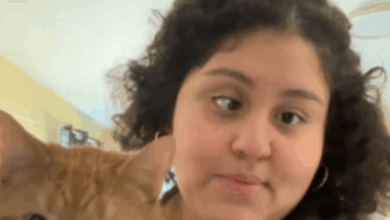 A misplaced MRI found a tumor on her spine. Doctors removed it through her eye in a first-of-its-kind surgery.