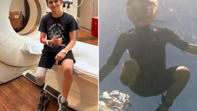 Dad recalls horrific moment 10-year-old son was attacked by shark in Florida