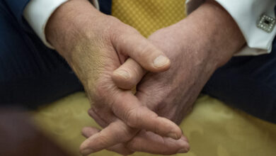 President Trump diagnosed with chronic venous insufficiency