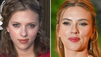 Scarlett Johansson — Good Genes or Good Docs?!