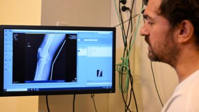 AI Tools May Degrade Doctors’ Skills