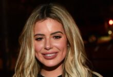 Brielle Biermann Undergoes 10 Procedures to Undo Under-Eye Filler