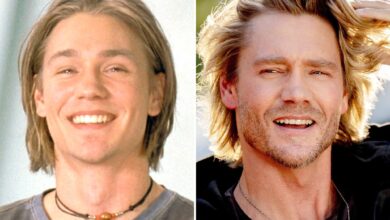 Chad Michael Murray — Good Genes or Good Docs?!