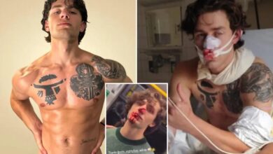 Syrian migrant accused of slashing hero American model John Rudat was previously let go by cops before being busted for gruesome attack