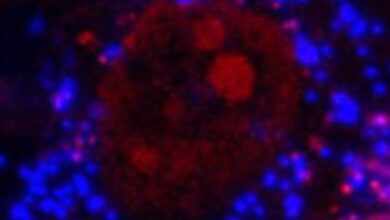 Microplastics linked to impaired bone health