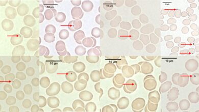Air pollution particles discovered hitching a ride around the body on red blood cells