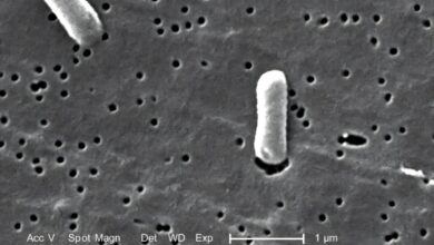 Microplastics found to change gut microbiome in first human-sample study