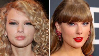 Taylor Swift Good Genes or Good Docs?!