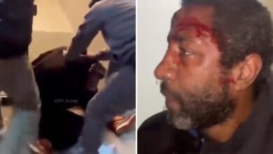 Brooklyn spitter left bloodied by two men ‘tired’ of his vile antics