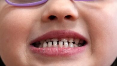 FDA restricts use of kids’ fluoride supplements, citing emerging health risks