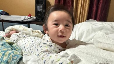 Baby defies all odds after growing outside his mom’s womb