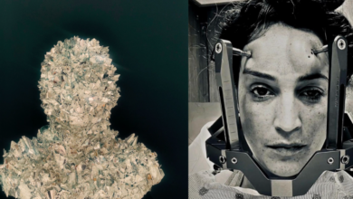 No one knew what was wrong with her — until an MRI found incurable disease. She turned her harrowing journey into unique art.