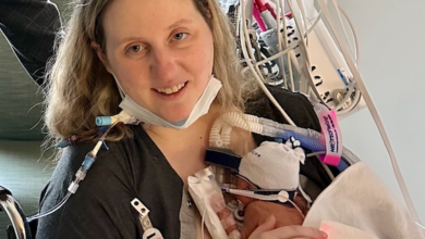 A mom-to-be started screaming in pain on her babymoon. Here’s how doctors saved her and her baby.