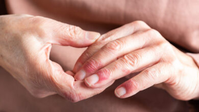 Roivant immune drug significantly outperformed placebo in treating rare skin disease