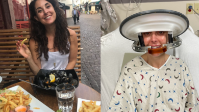 Woman shares unlikely survival journey after migraines led to glioblastoma diagnosis: “I am truly an outlier”