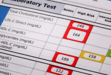 New heart disease guidelines suggest statins as early as age 30