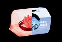 Organ transplant technology is advancing rapidly. So are the costs