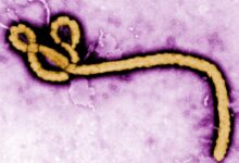 Ebola, hepatitis B, long Covid, Christianity: Morning Rounds