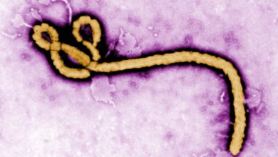 Ebola, hepatitis B, long Covid, Christianity: Morning Rounds