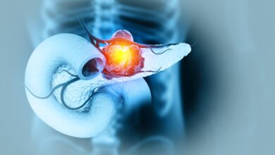 A New Way To Hit Pancreatic Cancer’s Hardest Target A New Way To Hit Pancreatic Cancer’s Hardest Target
