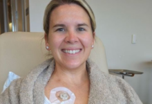 A mom’s Stage IV cancer had no symptoms. An innovative surgery saved her life.