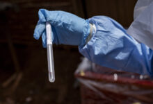 Americans exposed to DRC Ebola can access experimental treatment