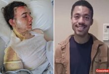 California McDonald’s manager speaks out after coworker threw oil on him