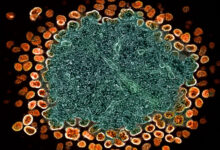 HIV, NIH, Ebola, gender care, puberty: Morning Rounds