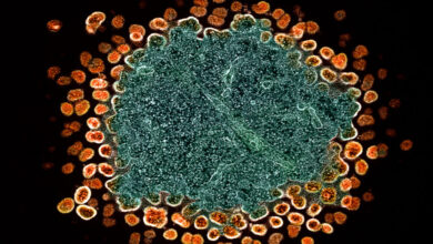 HIV, NIH, Ebola, gender care, puberty: Morning Rounds