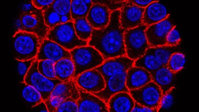 New drug nearly doubles survival rates in some pancreatic cancer patients, study says New drug nearly doubles survival rates in some pancreatic cancer patients, study says