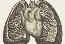What is pulmonary hypertension, and could GLP-1s help?