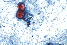 Cyclospora now in 29 states, more than 1,000 cases reported