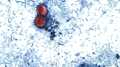Cyclospora now in 29 states, more than 1,000 cases reported Cyclospora now in 29 states, more than 1,000 cases reported